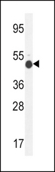 GCNT2 Antibody western blot of mouse kidney tissue lysates (35 ug/lane). The GCNT2 antibody detected the GCNT2 protein (arrow).