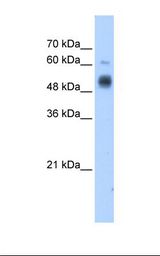Transfected 293T cell lysate. Antibody concentration: 1.25 ug/ml. Gel concentration: 12%.