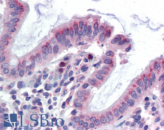 Anti-GCNT3 antibody LS-A9916 IHC of human colon. Immunohistochemistry of formalin-fixed, paraffin-embedded tissue after heat-induced antigen retrieval.