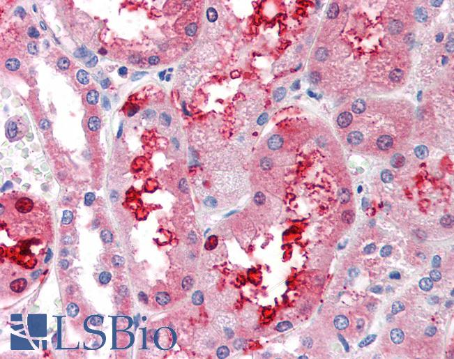 Anti-GCNT3 antibody LS-A9914 IHC of human kidney. Immunohistochemistry of formalin-fixed, paraffin-embedded tissue after heat-induced antigen retrieval.