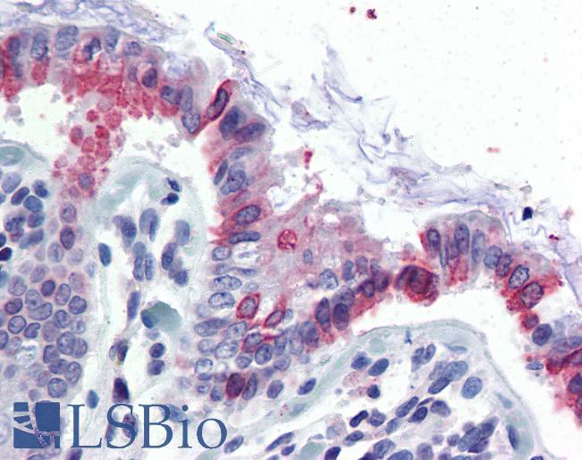 Anti-GCNT3 antibody LS-A9914 IHC of human colon. Immunohistochemistry of formalin-fixed, paraffin-embedded tissue after heat-induced antigen retrieval.