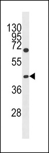 GCNT6 Antibody western blot of Jurkat cell line lysates (35 ug/lane). The GCNT6 antibody detected the GCNT6 protein (arrow).