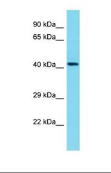Western blot of Human Fetal Brain. GCNT6 antibody dilution 1.0 ug/ml.