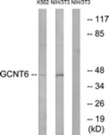 Western blot of extracts from NIH-3T3/K562 cells, using GCNT6 Antibody. The lane on the right is treated with the synthesized peptide.