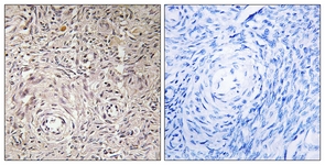 IHC of paraffin-embedded human ovary tissue, using GCNT7 Antibody. The picture on the right is treated with the synthesized peptide.