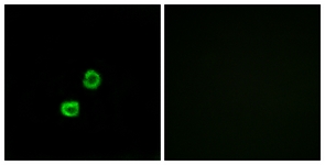 Immunofluorescence of MCF7 cells, using GCNT7 Antibody. The picture on the right is treated with the synthesized peptide.