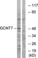Western blot of extracts from K562 cells, using GCNT7 Antibody. The lane on the right is treated with the synthesized peptide.