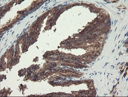 IHC of paraffin-embedded Human prostate tissue using anti-ACBD3 mouse monoclonal antibody.