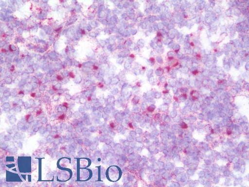 IHC with ACBD3 antibody on frozen human tonsil.