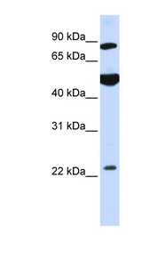 MOGS / GCS1 antibody LS-C102241 Western blot of HeLa lysate.