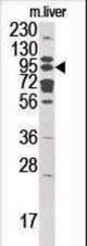 Western blot of anti-GCS1 antibody in mouse liver cell line lysate (35 ug/lane). GCS1(arrow) was detected using the purified antibody.