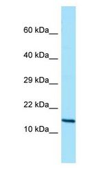 GCSH antibody Western Blot of Placenta.