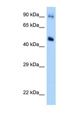GDA antibody LS-C146058 Western blot of MCF7 Cell lysate. Antibody concentration 1 ug/ml.