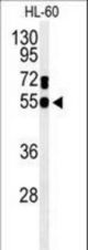 Western blot of GDA Antibody in HL-60 cell line lysates (35 ug/lane). GDA (arrow) was detected using the purified antibody.