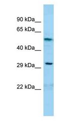 GDAP1 antibody Western Blot of OVCAR-3.