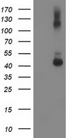 HEK293T cells were transfected with the pCMV6-ENTRY control (Left lane) or pCMV6-ENTRY GDAP1L1 (Right lane) cDNA for 48 hrs and lysed. Equivalent amounts of cell lysates (5 ug per lane) were separated by SDS-PAGE and immunoblotted with anti-GDAP1L1.