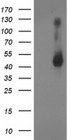 HEK293T cells were transfected with the pCMV6-ENTRY control (Left lane) or pCMV6-ENTRY GDAP1L1 (Right lane) cDNA for 48 hrs and lysed. Equivalent amounts of cell lysates (5 ug per lane) were separated by SDS-PAGE and immunoblotted with anti-GDAP1L1.