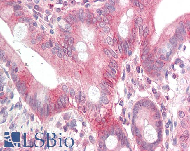 Human, Small Intestine: Formalin-Fixed Paraffin-Embedded (FFPE)
