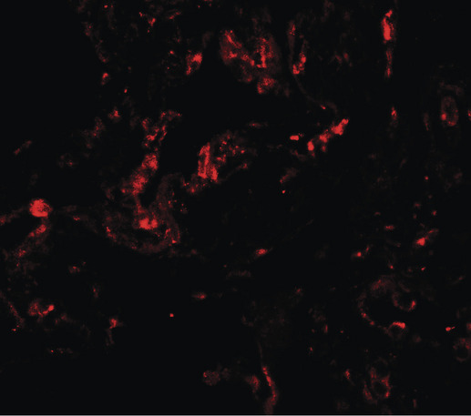 Immunofluorescence of GDF1 in human lung tissue with GDF1 antibody at 20 ug/ml.