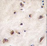 Formalin-fixed and paraffin-embedded human brain tissue reacted with GDF1 antibody , which was peroxidase-conjugated to the secondary antibody, followed by DAB staining. This data demonstrates the use of this antibody for immunohistochemistry; clinical relevance has not been evaluated.