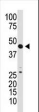 The anti-GDF3 N-term antibody is used in Western blot to detect GDF3 in mouse kidney tissue lysate.