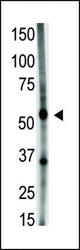 The anti-GDF5 N-term antibody is used in Western blot to detect GDF5 in A549 cell lysate.