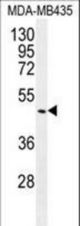 GDF5 Antibody western blot of MDA-MB435 cell line lysates (35 ug/lane). The GDF5 antibody detected the GDF5 protein (arrow).