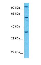 Western blot of COPS6 Antibody with human Fetal Lung lysate.