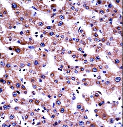 GDI2 Antibody immunohistochemistry of formalin-fixed and paraffin-embedded human liver tissue followed by peroxidase-conjugated secondary antibody and DAB staining.