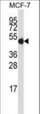 GDI2 Antibody western blot of MCF-7 cell line lysates (35 ug/lane). The GDI2 antibody detected the GDI2 protein (arrow).
