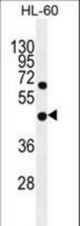 GDPD1 Antibody western blot of HL-60 cell line lysates (35 ug/lane). The GDPD1 antibody detected the GDPD1 protein (arrow).