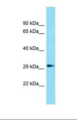 Western blot of Rat Muscle. Gdpd1 antibody dilution 1.0 ug/ml.