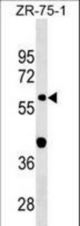 GDPD2 Antibody western blot of ZR-75-1 cell line lysates (35 ug/lane). The GDPD2 Antibody detected the GDPD2 protein (arrow).