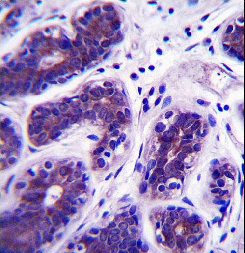 GDPD3 Antibody immunohistochemistry of formalin-fixed and paraffin-embedded human breast tissue followed by peroxidase-conjugated secondary antibody and DAB staining.