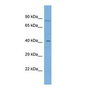 Western blot of Human COLO205. GDPD5 antibody dilution 1.0 ug/ml.