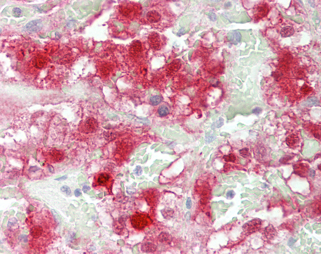 Human Adrenal: Formalin-Fixed, Paraffin-Embedded (FFPE)