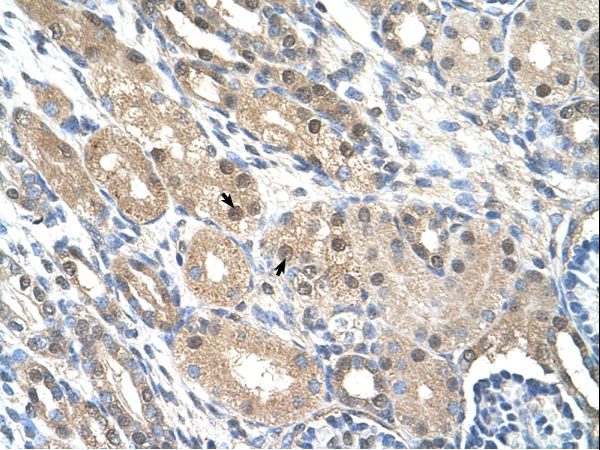 GEM antibody LS-C31885 was used in IHC to stain formalin-fixed, paraffin-embedded human kidney.