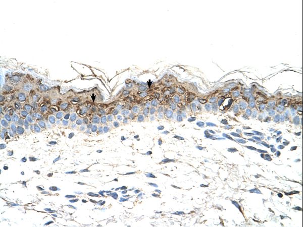 GEM antibody LS-C31885 was used in IHC to stain formalin-fixed, paraffin-embedded human skin.