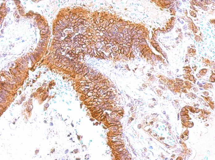GEM antibody [N1], N-term detects GEM protein at membrane on lung by immunohistochemical analysis. Sample: Paraffin-embedded lung. GEM antibody [N1], N-term dilution:1:500.
