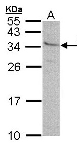 Sample (30 ug of whole cell lysate). A:293T. 12% SDS PAGE. GEM / KIR antibody diluted at 1:500.