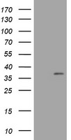HEK293T cells were transfected with the pCMV6-ENTRY control (Left lane) or pCMV6-ENTRY COPS6 (Right lane) cDNA for 48 hrs and lysed. Equivalent amounts of cell lysates (5 ug per lane) were separated by SDS-PAGE and immunoblotted with anti-COPS6.