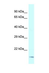 GEMIN6 antibody LS-C145723 Western blot of Fetal Lung lysate. Antibody concentration 1 ug/ml.