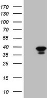 HEK293T cells were transfected with the pCMV6-ENTRY control (Left lane) or pCMV6-ENTRY GEMIN8 (Right lane) cDNA for 48 hrs and lysed. Equivalent amounts of cell lysates (5 ug per lane) were separated by SDS-PAGE and immunoblotted with anti-GEMIN8.