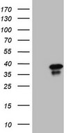 HEK293T cells were transfected with the pCMV6-ENTRY control (Left lane) or pCMV6-ENTRY GEMIN8 (Right lane) cDNA for 48 hrs and lysed. Equivalent amounts of cell lysates (5 ug per lane) were separated by SDS-PAGE and immunoblotted with anti-GEMIN8.
