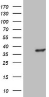 HEK293T cells were transfected with the pCMV6-ENTRY control (Left lane) or pCMV6-ENTRY GEMIN8 (Right lane) cDNA for 48 hrs and lysed. Equivalent amounts of cell lysates (5 ug per lane) were separated by SDS-PAGE and immunoblotted with anti-GEMIN8.