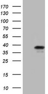 HEK293T cells were transfected with the pCMV6-ENTRY control (Left lane) or pCMV6-ENTRY GEMIN8 (Right lane) cDNA for 48 hrs and lysed. Equivalent amounts of cell lysates (5 ug per lane) were separated by SDS-PAGE and immunoblotted with anti-GEMIN8.