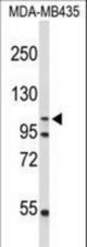 Western blot of GEN1 Antibody in MDA-MB435 cell line lysates (35 ug/lane). GEN1 (arrow) was detected using the purified antibody;