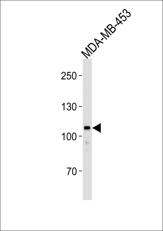 Western blot of lysate from MDA-MB-453 cell line, using GEN1 Antibody. Antibody was diluted at 1:1000. A goat anti-rabbit IgG H&L (HRP) at 1:5000 dilution was used as the secondary antibody. Lysate at 35ug.