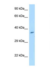 GET4 antibody LS-C146047 Western blot of MCF7 Cell lysate. Antibody concentration 1 ug/ml.