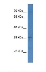 Western blot of Human COLO205. GET4 antibody dilution 1.0 ug/ml.